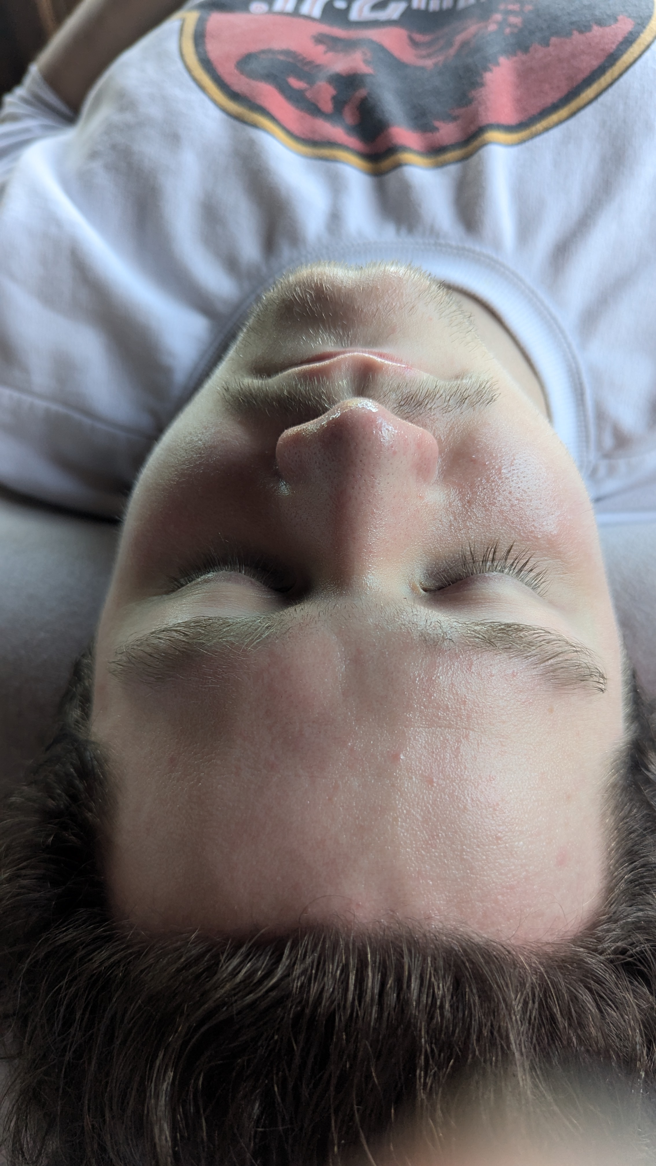 After brows